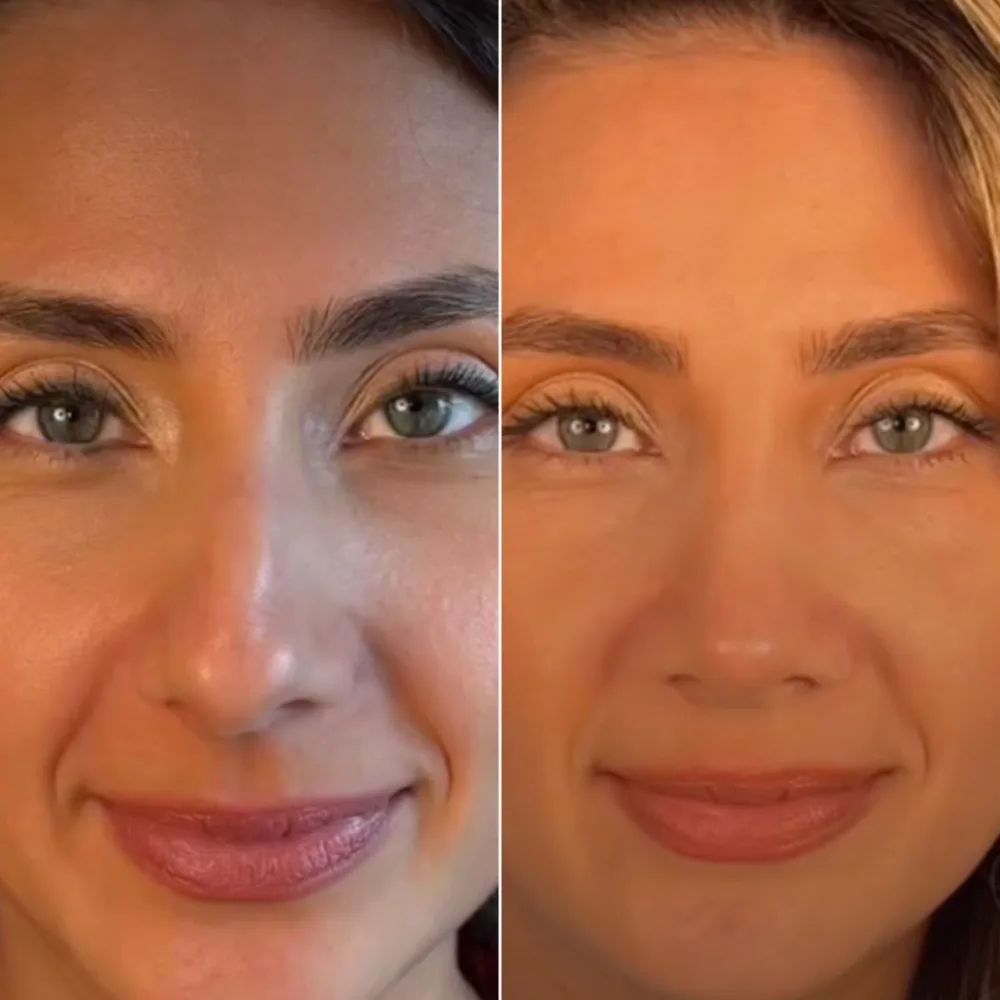 Before and after — case 10
