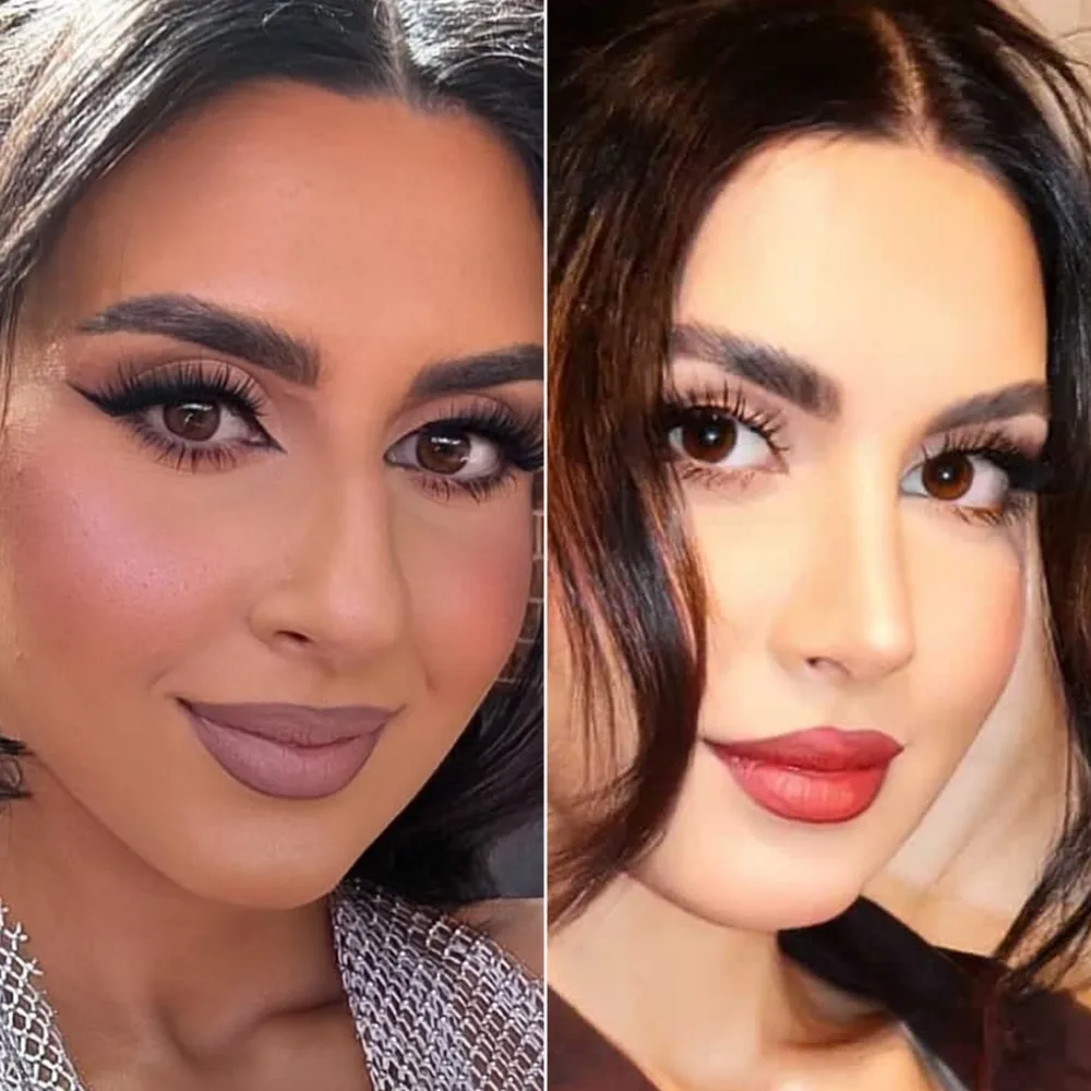 Before and after — case 01
