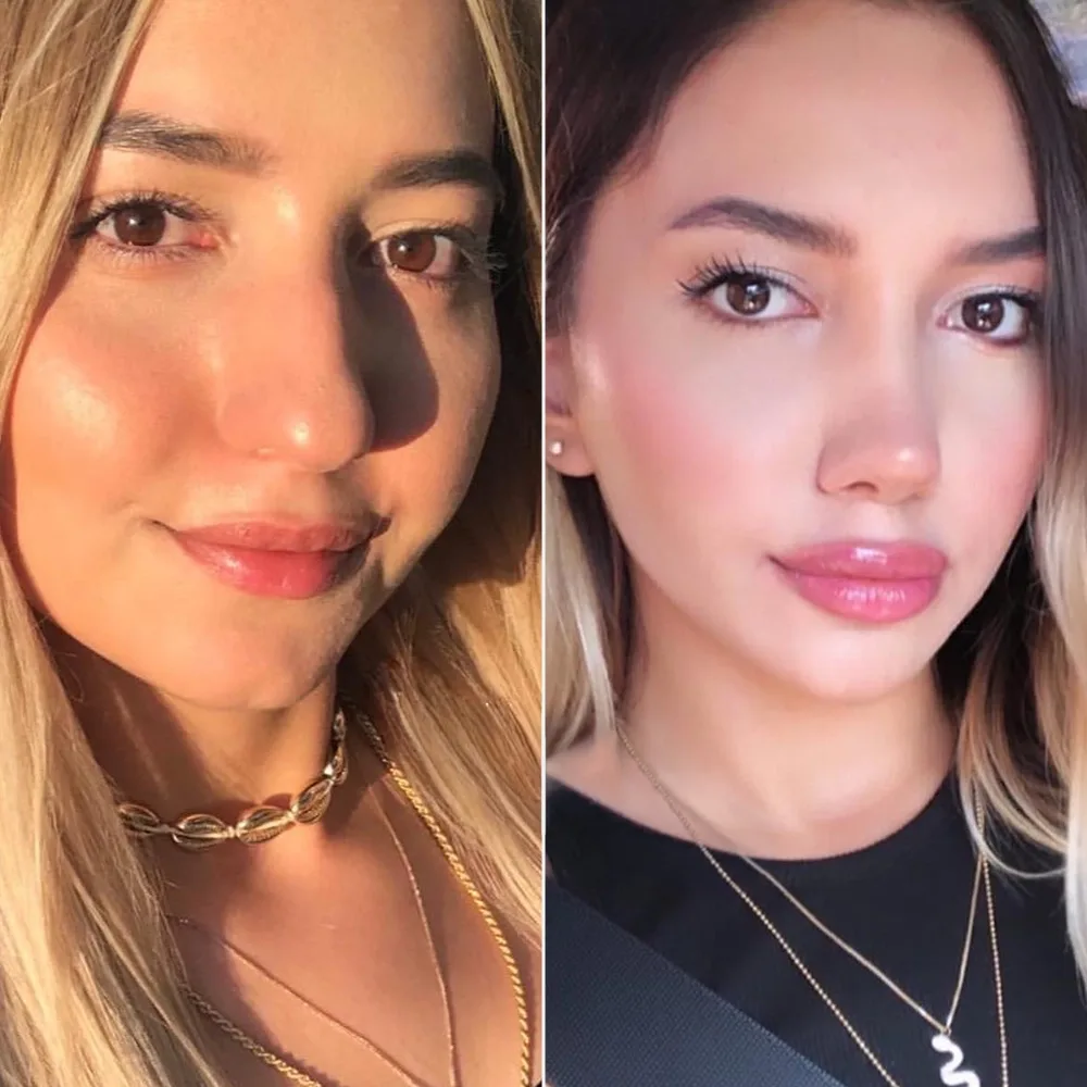 Before and after — case 08