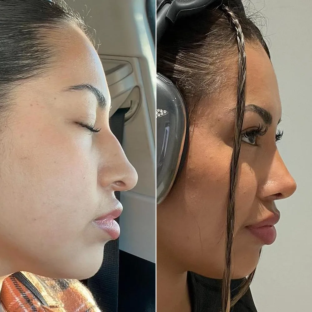 Before and after — case 07