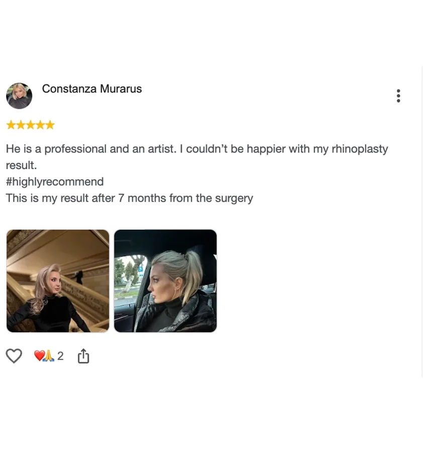Constanza Murarus — rhinoplasty result