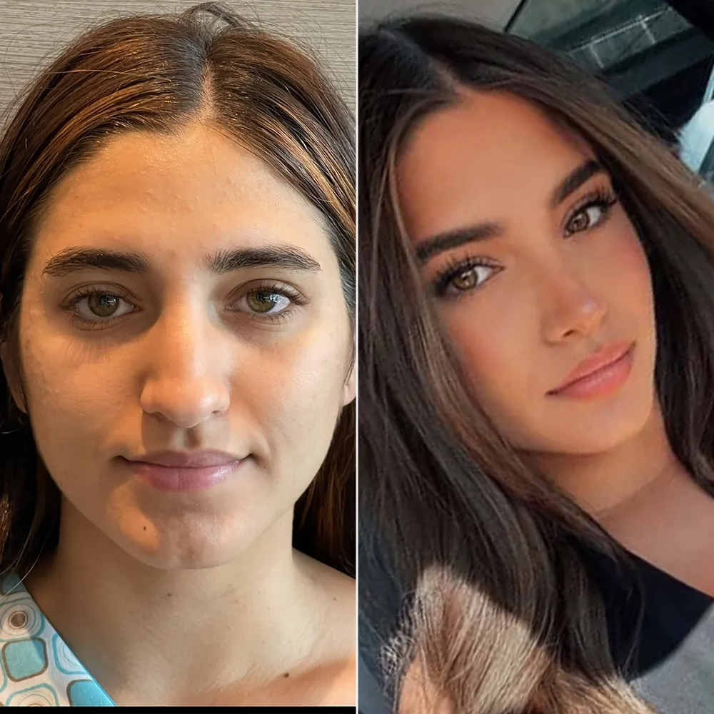 Before and after — case 03