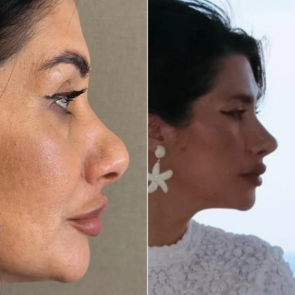Before and after — case 03