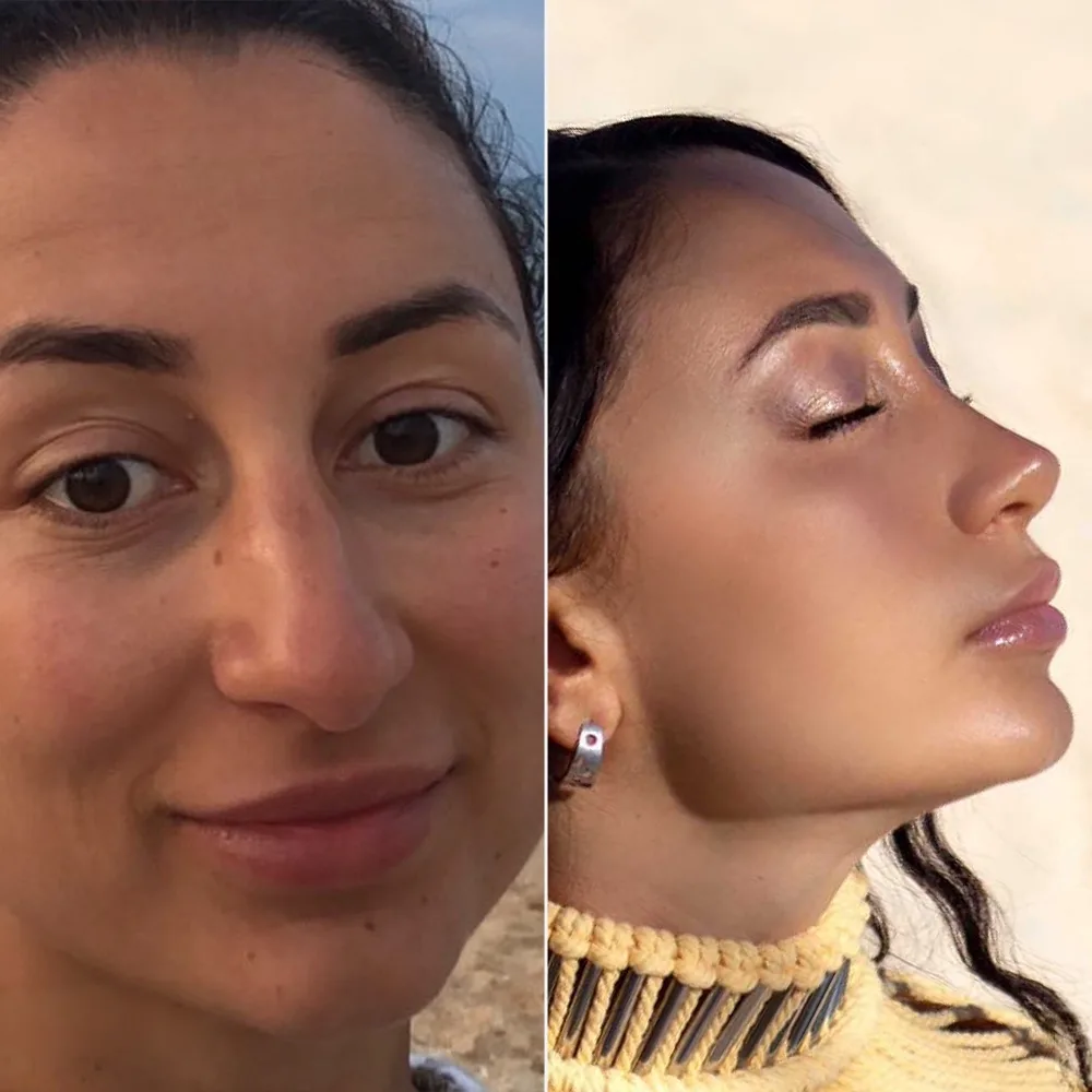 Before and after — case 12