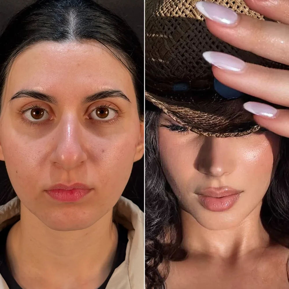 Before and after — case 01