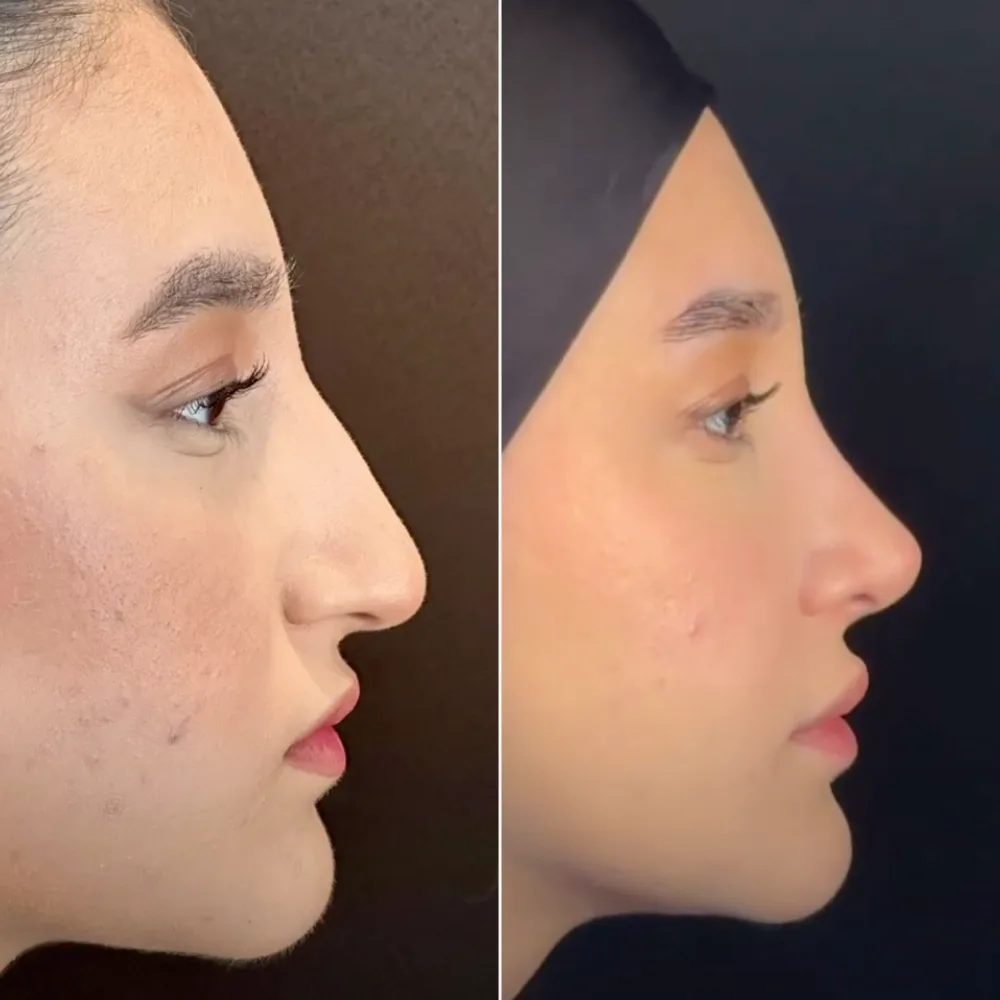 Before and after — case 09