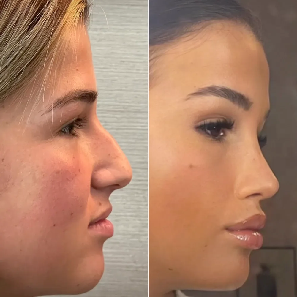 Before and after — case 08