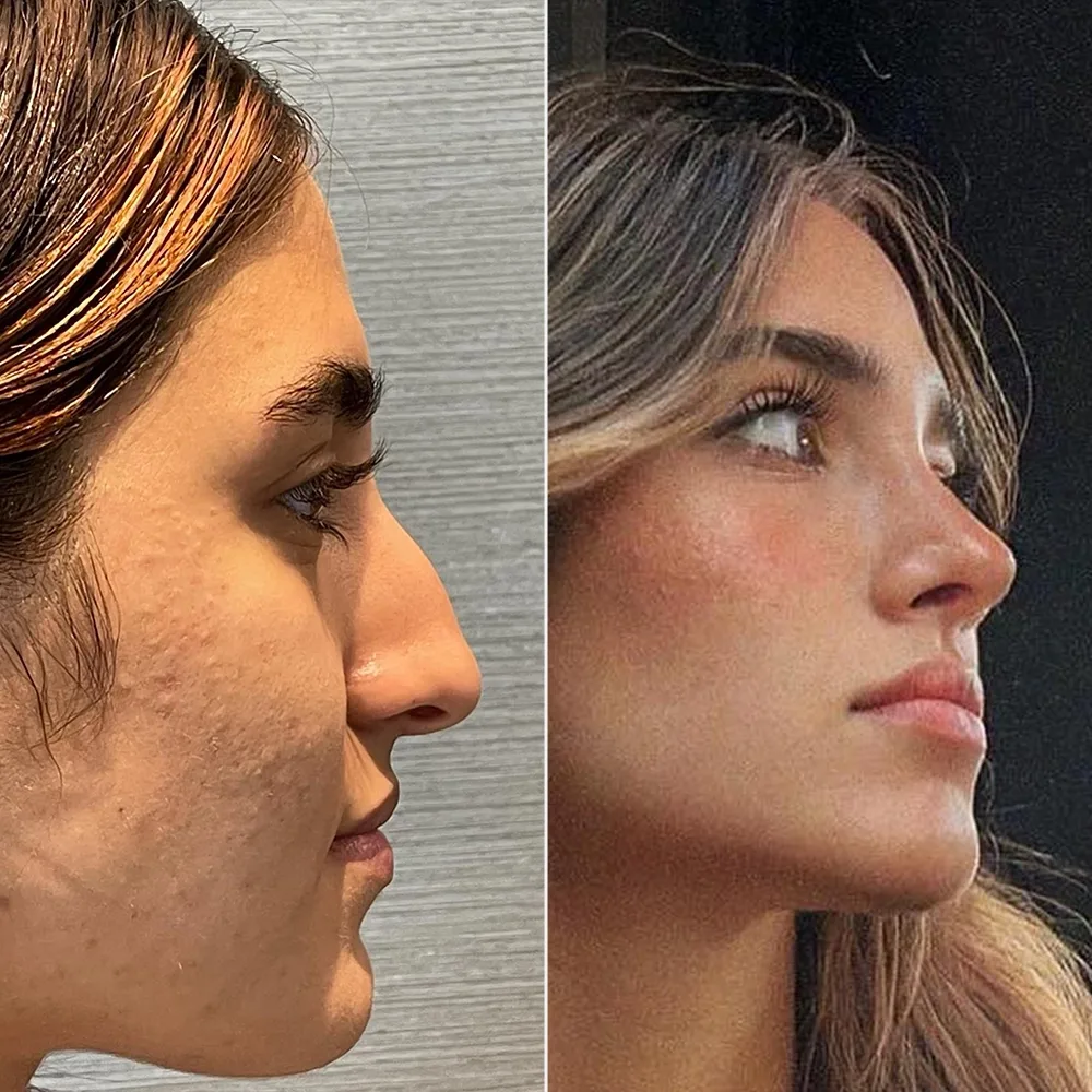 Before and after — case 01