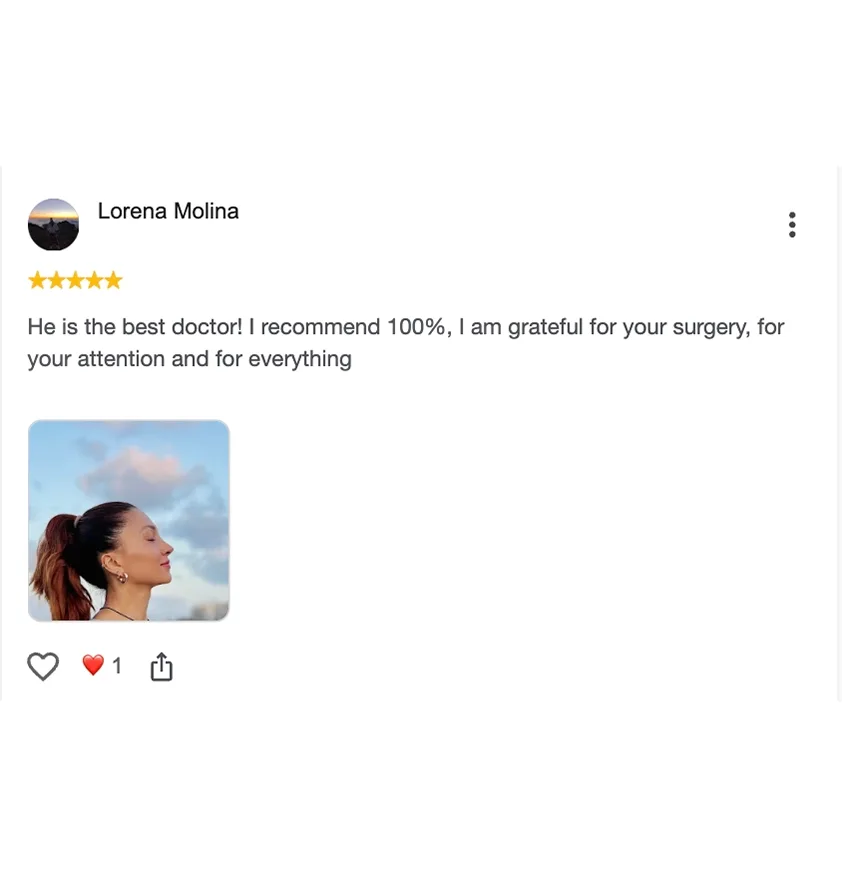 Lorena Molina — rhinoplasty result