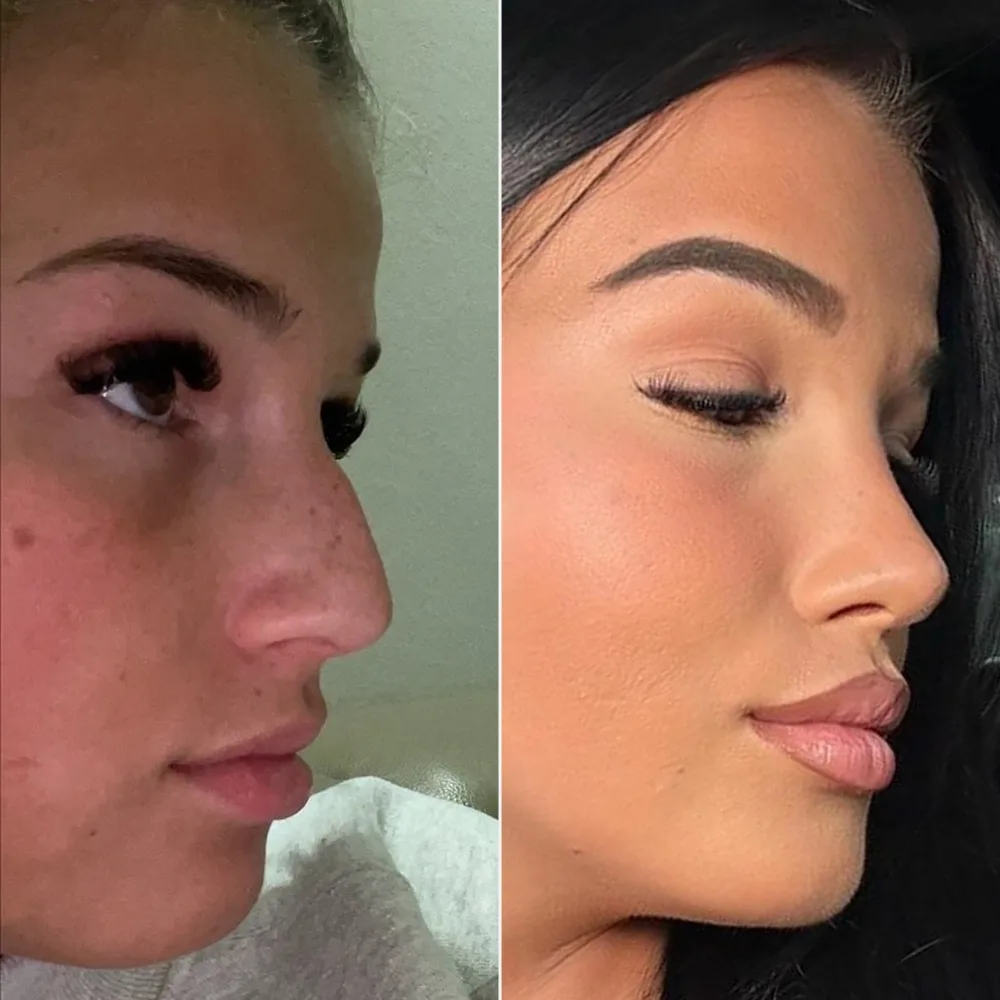 Before and after — case 04