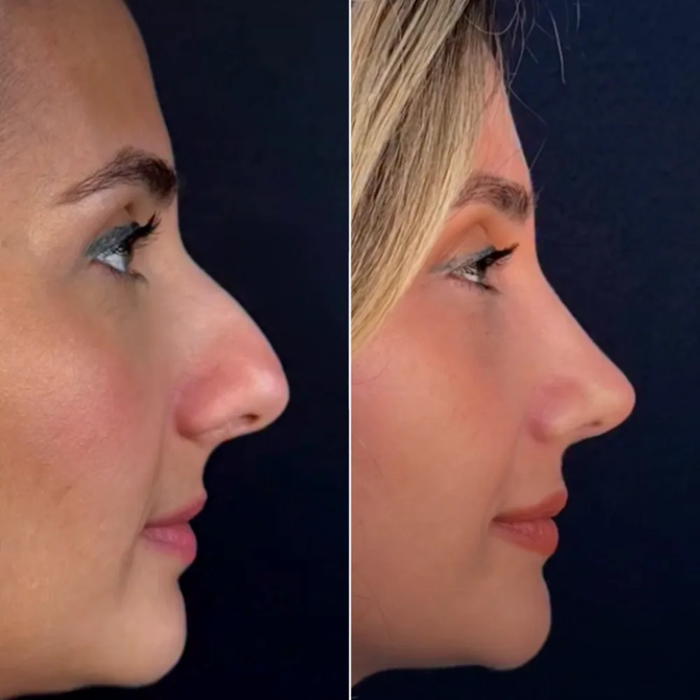 Before and after — case 06