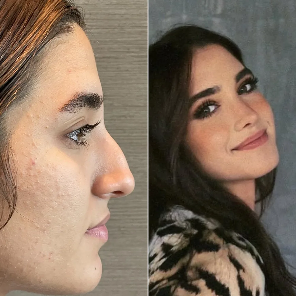 Before and after — case 03