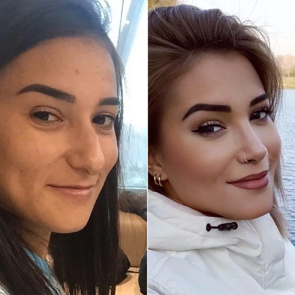 Before and after — case 15