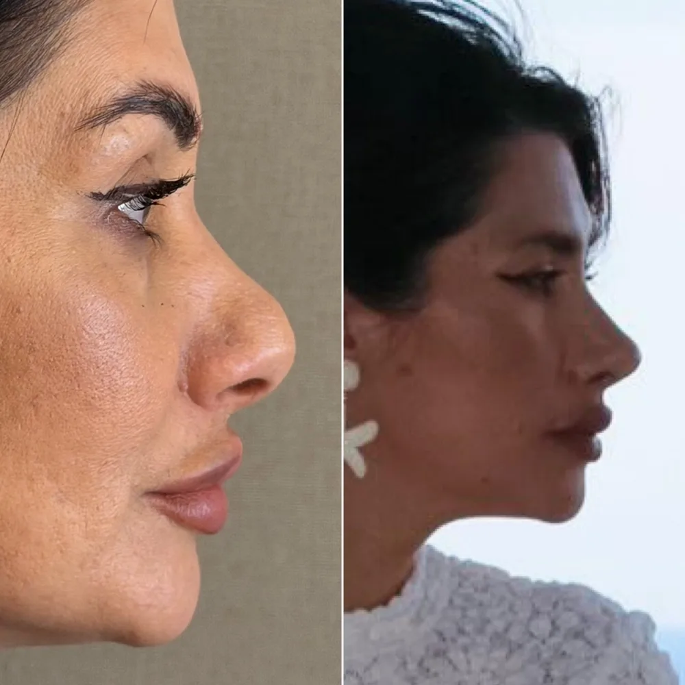 Before and after — case 06
