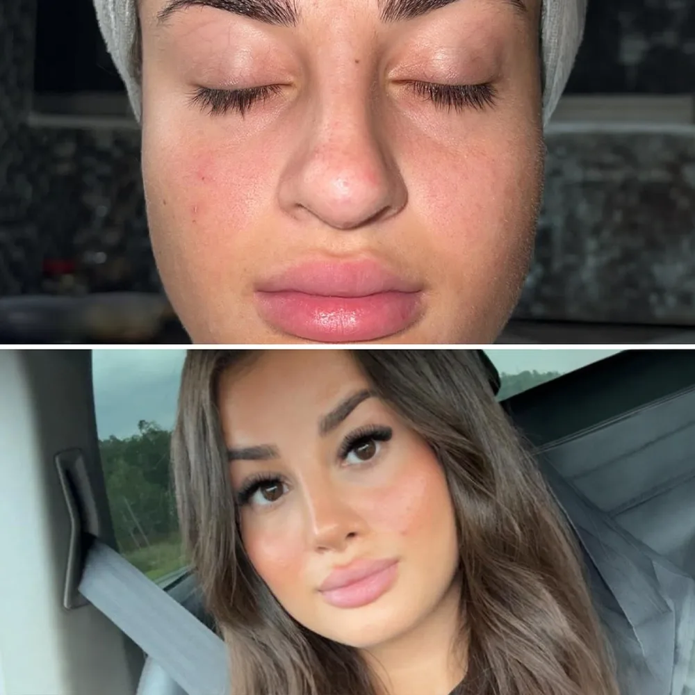 Before and after — case 05