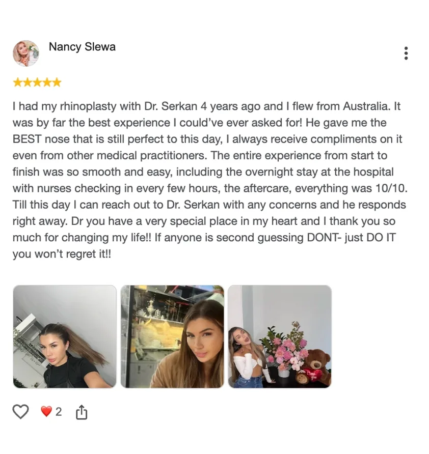 Nancy Slewa — rhinoplasty result
