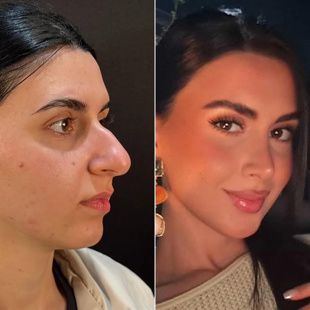 Before and after — case 09