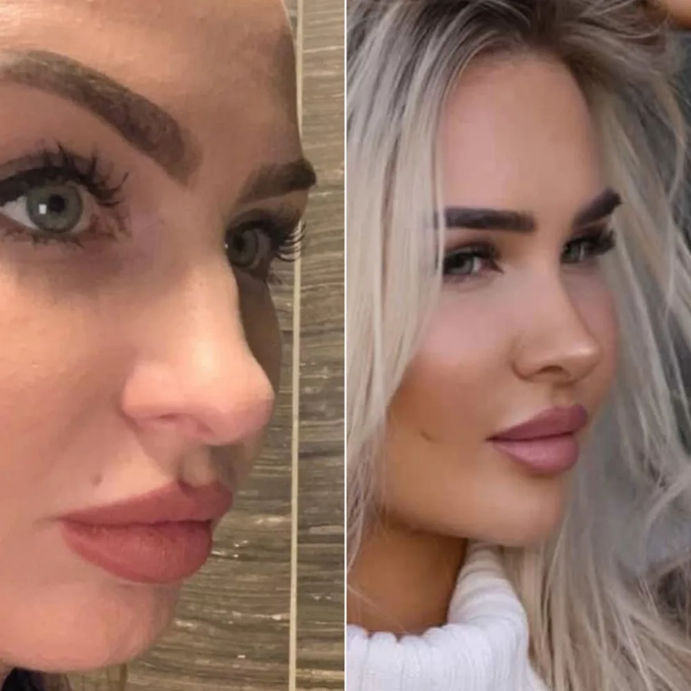 Before and after — case 02