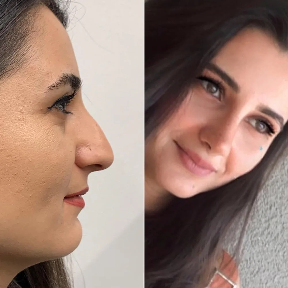 Before and after — case 05